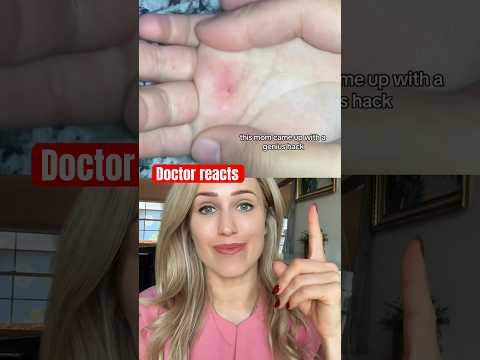 Doctor reacts: genius splinter life hack