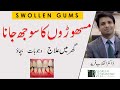 Gum Swelling Never Get Gum Swelling Again Home Treatment Urdu Hindi