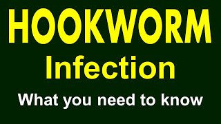 Hookworm infection | Identification of hookworm infection | Diagnosis, treatment and prevention