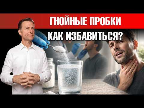 Лучшее натуральное средство от боли в горле: есть у каждого дома🙌