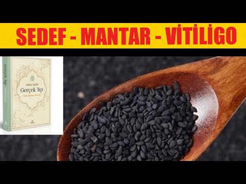 SEDEF, MANTAR, VİTİLİGO DA ÇÖREK OTU / YAĞI | AİDİN SALİH | GERÇEK TIP