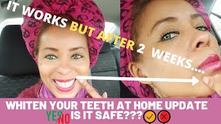 Whiten Your Teeth At Home Update–I am Happy With The Results 