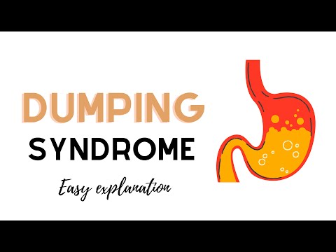 Dumping Syndrome