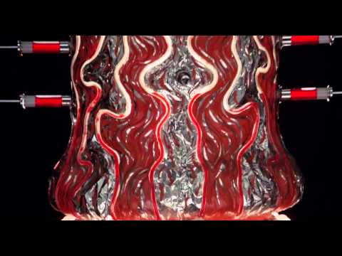 Tina Turner - Acid Queen - Tommy