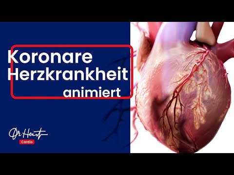 Koronare Herzkrankheit - anschaulich animiert! | Dr. Heart