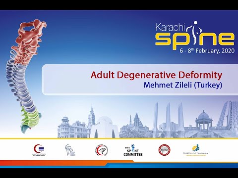 5 Adult Degenerative Deformity