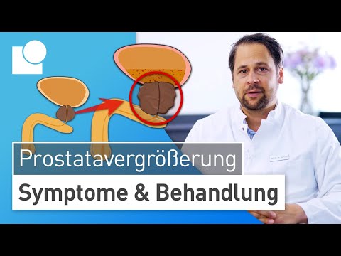 Prostatavergrößerung: Das hilft bei Harndrang & schwachem Harnstrahl | Symptome & Behandlung