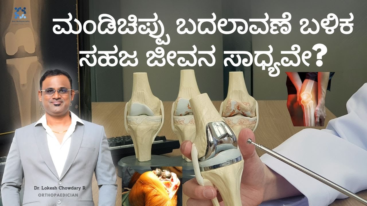 ಮಂಡಿಚಿಪ್ಪು ಬದಲಾವಣೆ: ಸಾಧಕ ಬಾಧಕಗಳೇನು?  Dr. Lokesh Chowdary