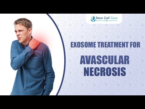 Exosome Therapy for Avascular Necrosis | Advanced Regenerative Treatment