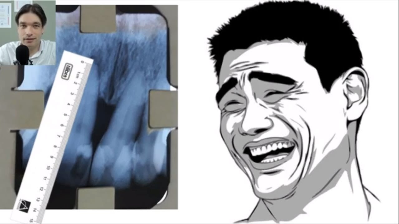 ODONTOMETRIA passo a passo - técnica convencional (Nível Graduação)