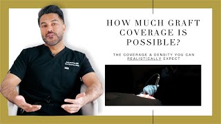 Canadian Hair Transplant Centre