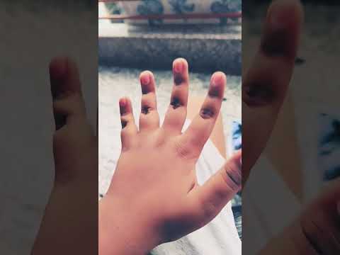 my finger 🤣🤣🤣🤣🤣🤣🤣🤣🤣🤣🤣🤣