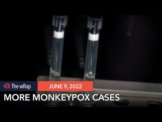 More than 1,000 monkeypox cases reported to WHO – briefing