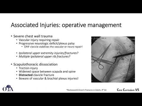 Clavicle Fractures - 1 of 2