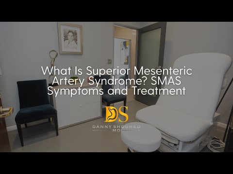 What is Superior Mesenteric Artery Syndrome? SMAS Symptoms and Treatment
