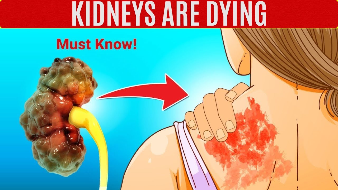 KIDNEYS are DYING! 10 Weird Signs of KIDNEY DAMAGE
