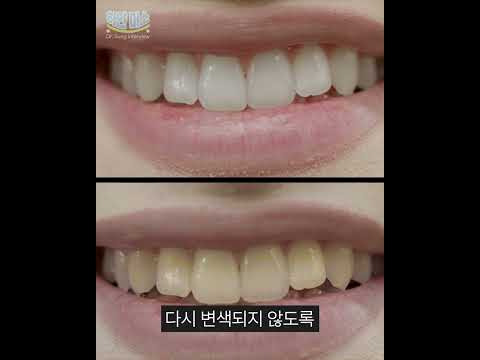 1주 만에 치아 하얘지는 성분