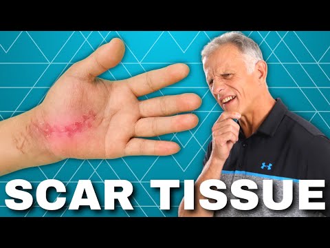 How to Get Rid of Scar Tissue After Surgery or Injury (Hardened?)