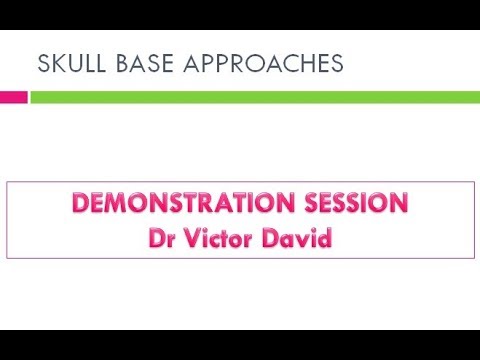 Mastoidectomy and trans labyrinthine approach –