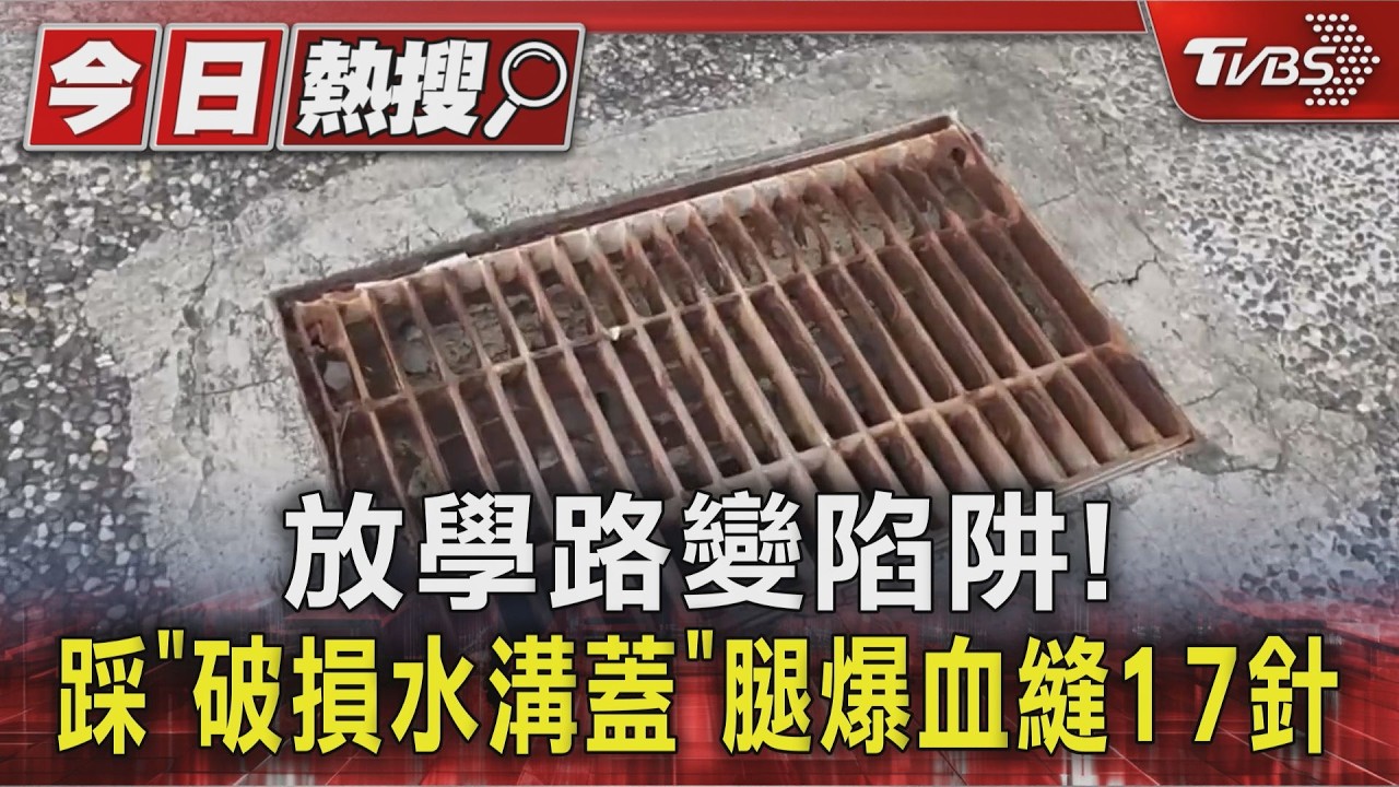 影音／放學路變陷阱！國一生踩「破損水溝蓋」大腿割傷爆血縫17針