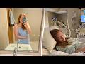 Woman S Bruise Turns Out To Be Sinister Sign Of Rare Syndrome SWNS