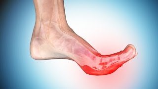 Foot Cramps: Causes and Ways to Get Rid of Cramps in Foot and Toe
