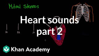 Systolic murmurs, diastolic murmurs, and extra heart sounds - Part 2 | NCLEX-RN | Khan Academy