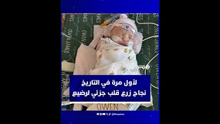 لأول مرة في التاريخ نجاح زرع قلب جزئي لرضيع thumbnail