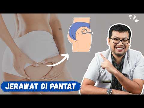 PENYEBAB DAN CARA MENGATASI JERAWAT DI PANTAT - DOKTER SADDAM ISMAIL