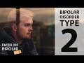 Faces of Bipolar Disorder (PART 3) "Bipolar Type 2"
