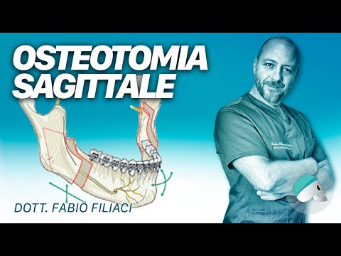 Frattura da compressione della colonna vertebrale di trattamento in Israele Rottura del legamento crociato anteriore del ginocchio risonanza magnetica articolare