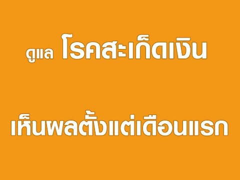 การรักษาทั่วไปสำหรับโรคสะเก็ดเงิน วัวครีมโรคสะเก็ดเงิน