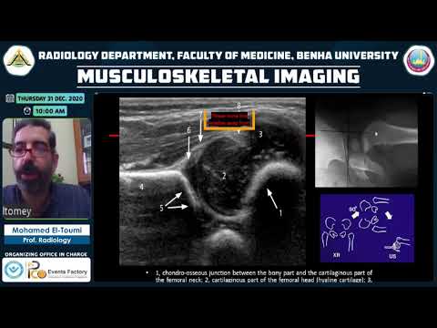 Imaging of pediatric hip joint