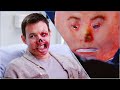 Man went for plastic surgery but got laughed at by doctors