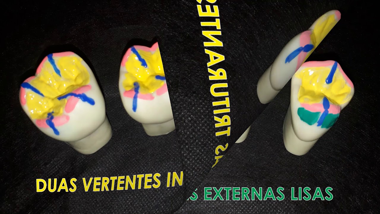 Anatomia Dental: O Segredo para uma boa escultura