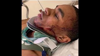 YBN Almighty Jay (JUMPED &amp; ROBBED) Left Hospitalized In NYC