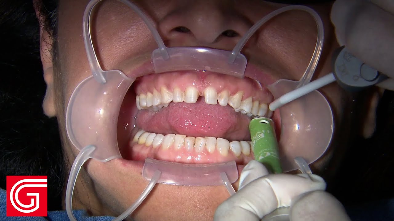 Jose David Torres Hernandez-38