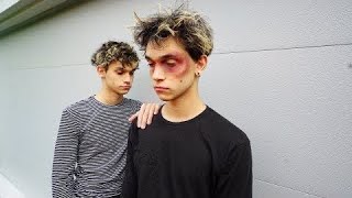 MY TWIN BROTHER GOT BEAT UP.