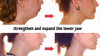 Align lower teeth without braces. Expand and strengthen the lower jaw. Correct bite. Exercises.