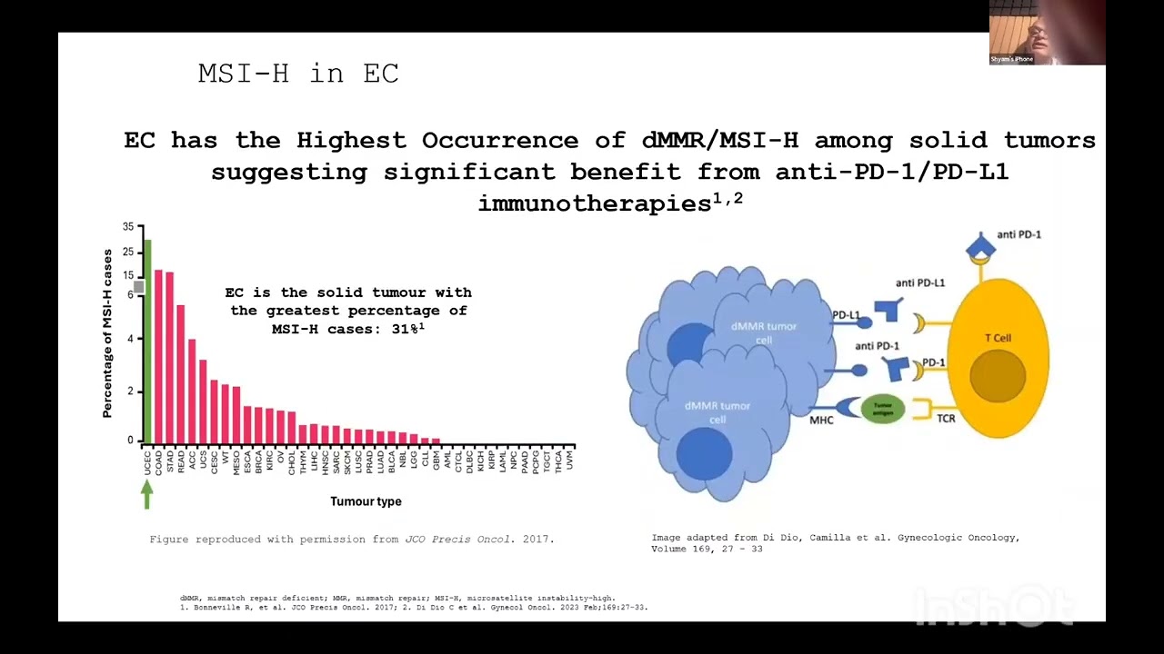 Evolving Treatment Paradigm with Immunotherapy in Endometrial Cancer