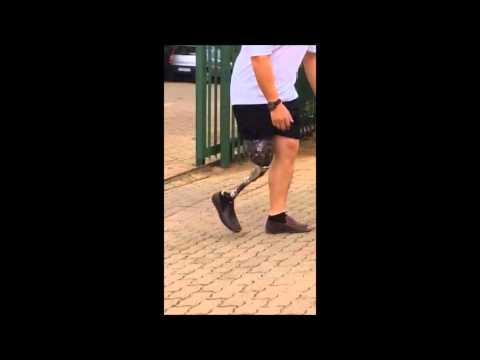 Werner walking on his brand new prosthetic up & down hills