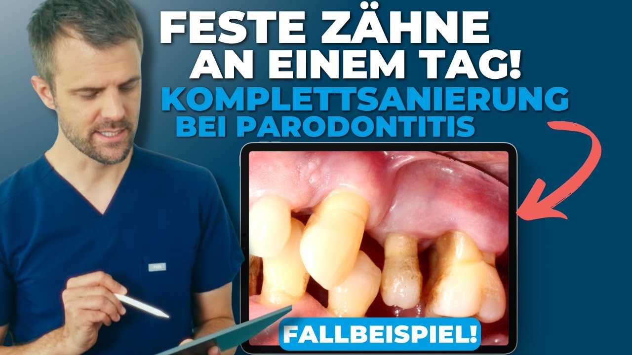 Video-Vorschaubild