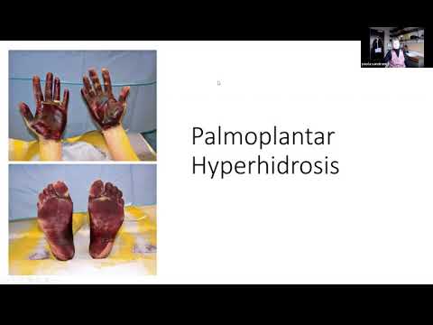 Grand Rounds. Autonomic disorders. Dr. Sandroni. 11/19/2021