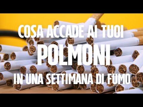 Che accettare da alcolismo di birra I centri di trattamento di alcolismo in Barnaul