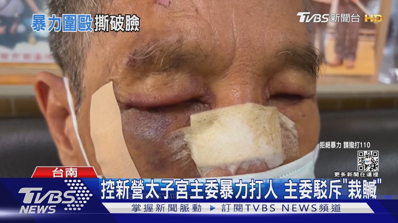 疫情不開管委會卻辦歌唱比賽 質疑廟方主委反被圍毆