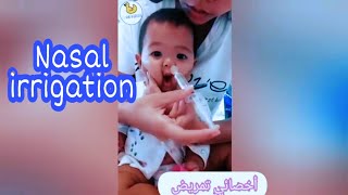 Nasal irrigation with normal saline for baby