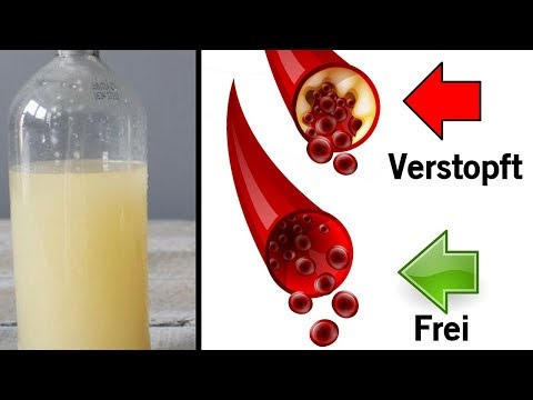 Metzger Hypertonie gipertofort Hypertonie Symptome und Behandlung