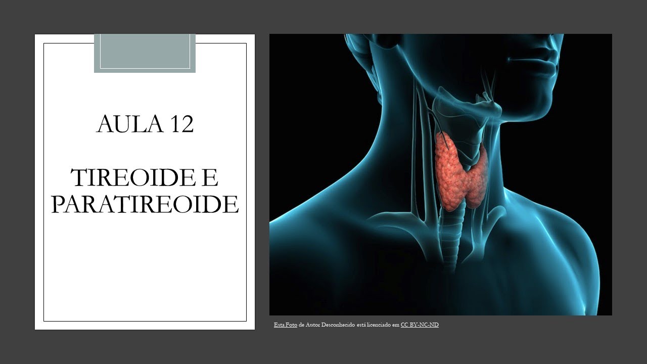 Videoaula 12 Tireoide e Paratireoide