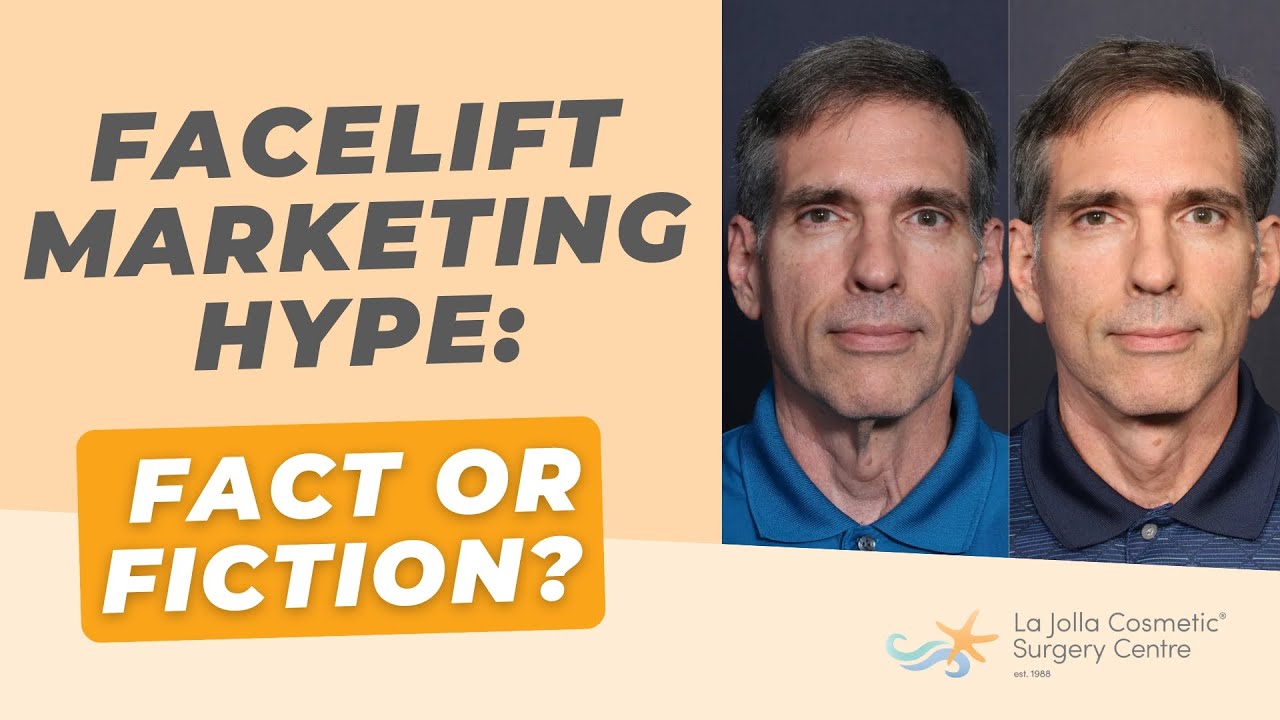 Facelift Marketing Hype: Fact or Fiction?