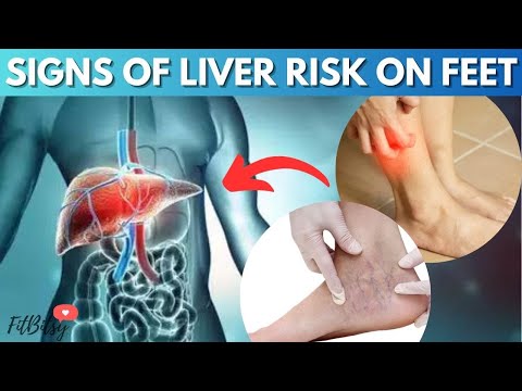 9 Signs of liver health your feet can reveal